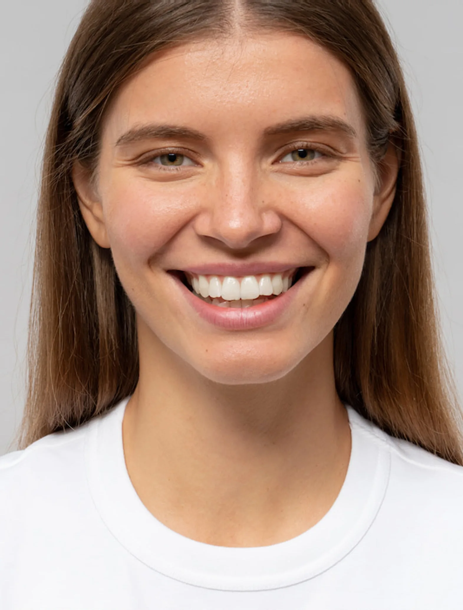 Digital Smile Design