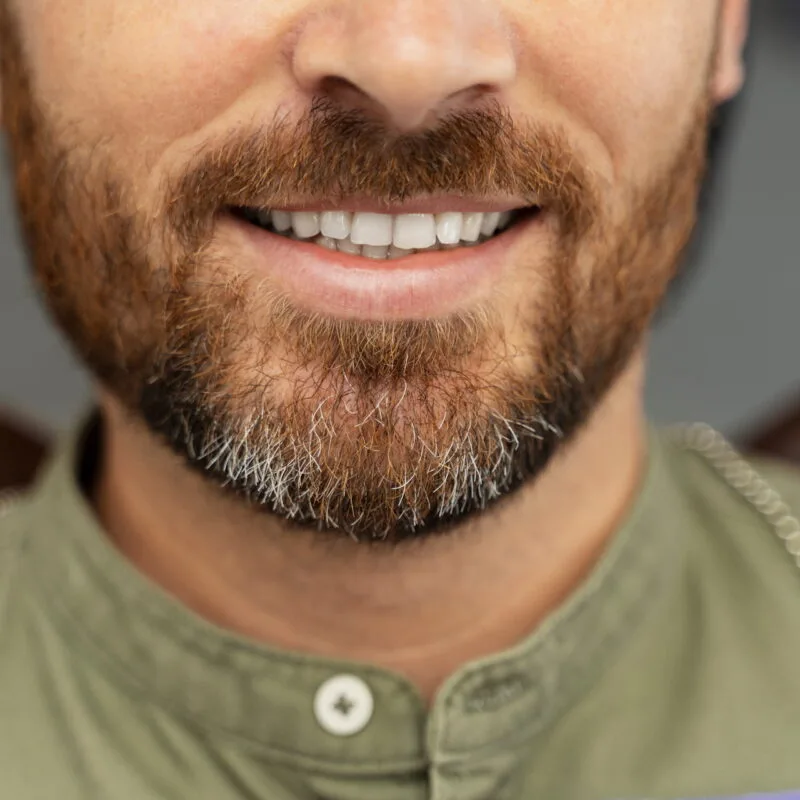 Γέφυρες σε Εμφυτεύματα