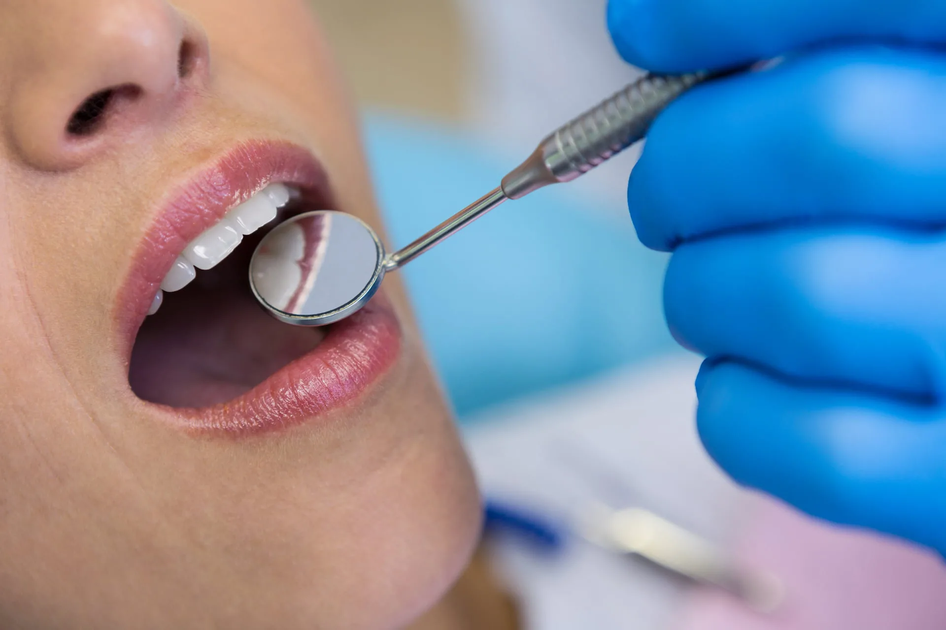 Check-up Δοντιών